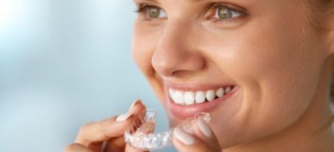 Wie man das richtige Zahnaufhellungsset aussucht?